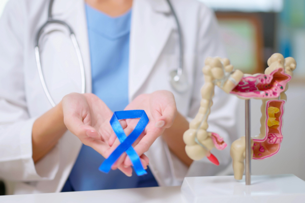 5 Myths about Colon Cancer